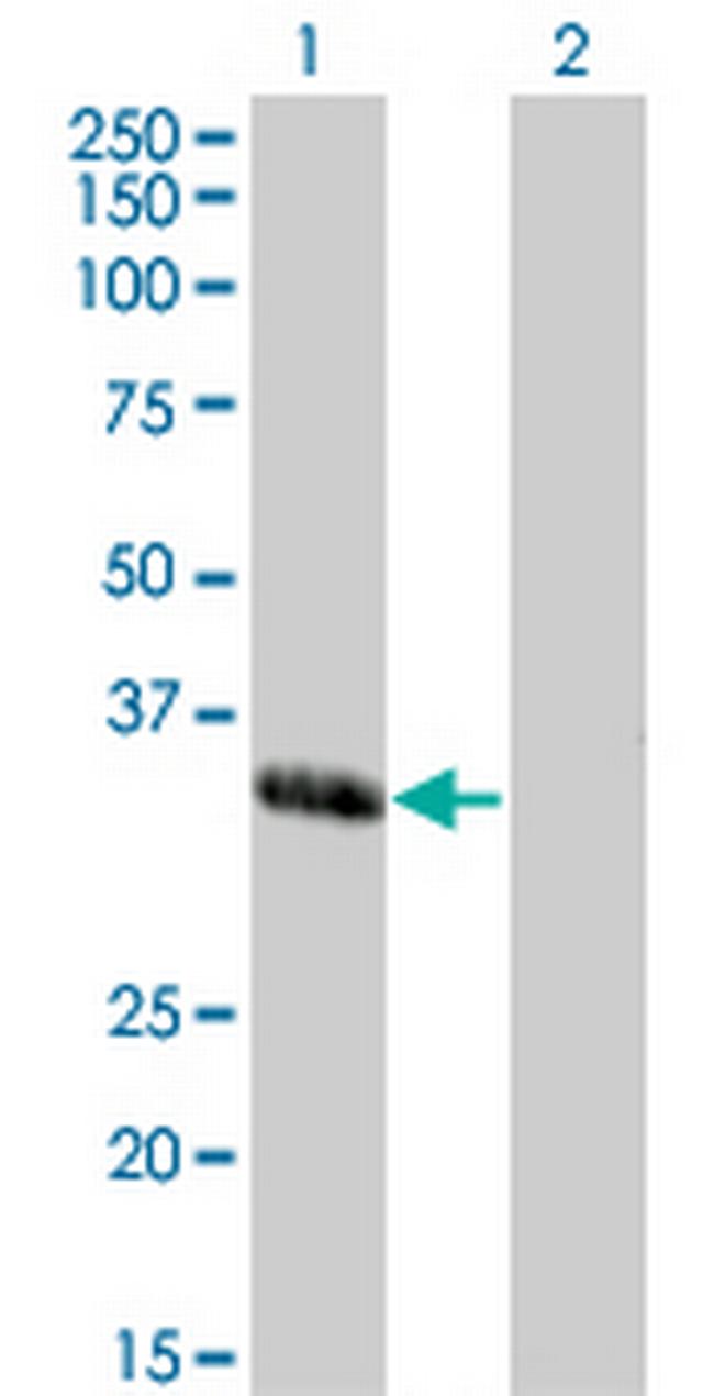 MEOX1 Antibody in Western Blot (WB)