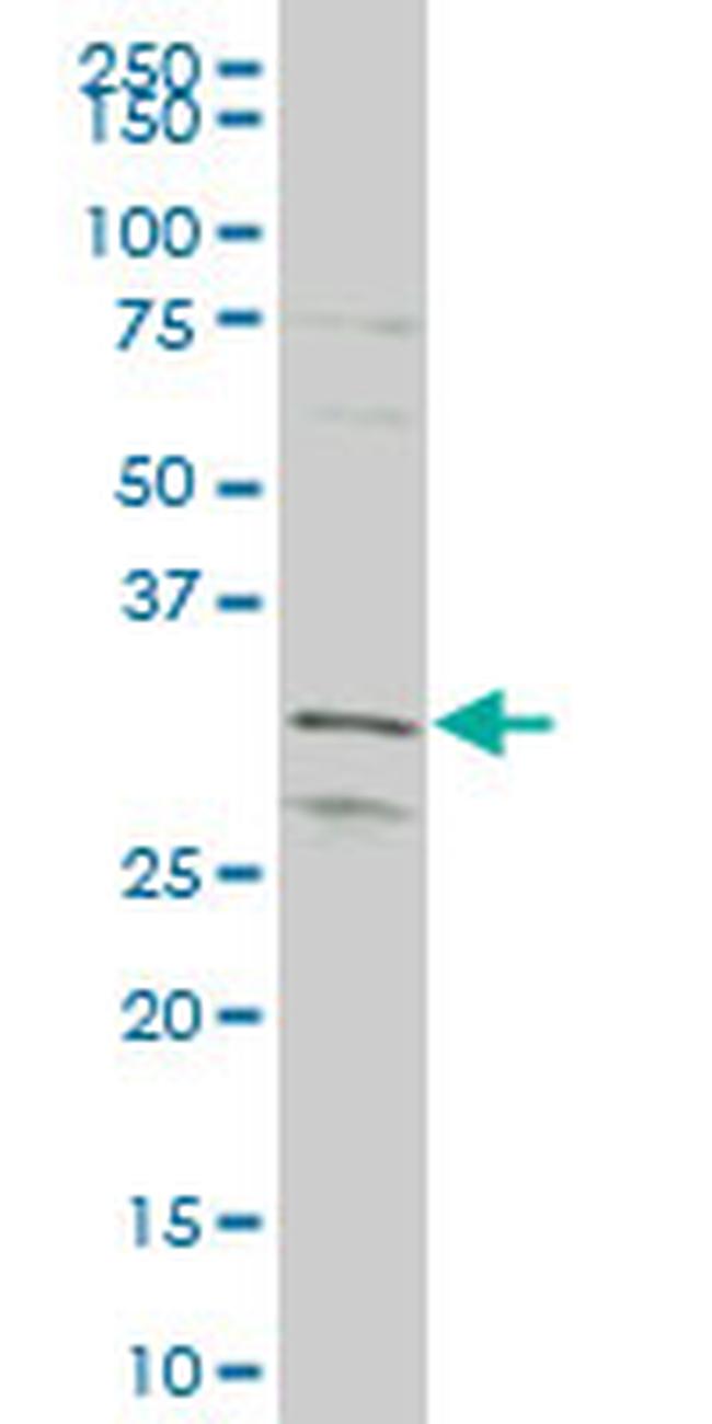 MEOX1 Antibody in Western Blot (WB)