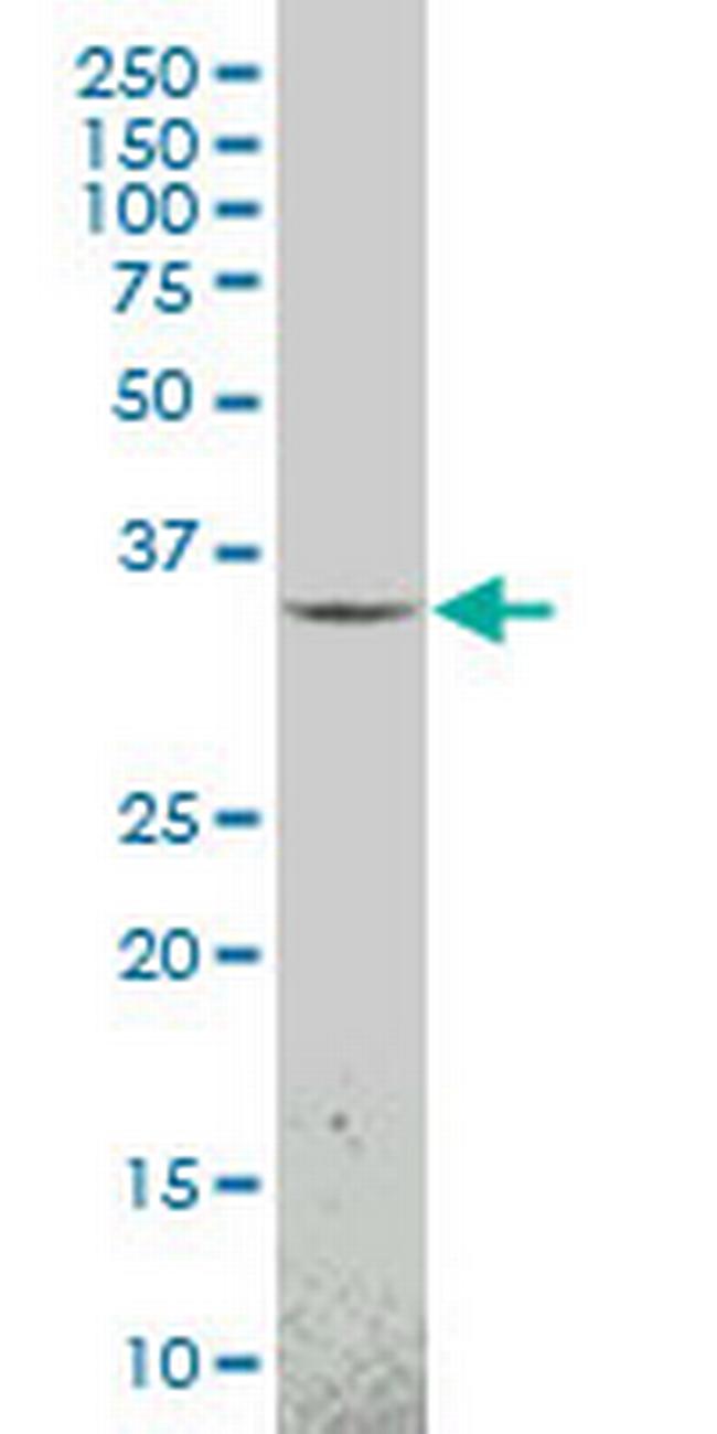 MEOX1 Antibody in Western Blot (WB)