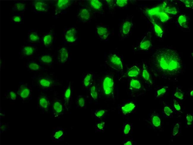 MEOX2 Antibody in Immunocytochemistry (ICC/IF)