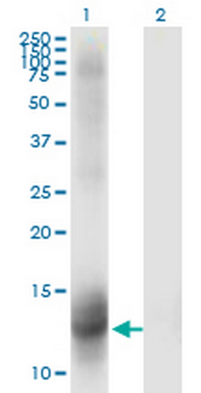 NR3C2 Antibody in Western Blot (WB)