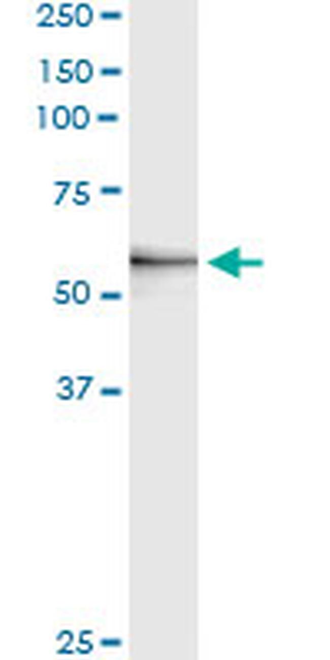 MMP3 Antibody in Immunoprecipitation (IP)