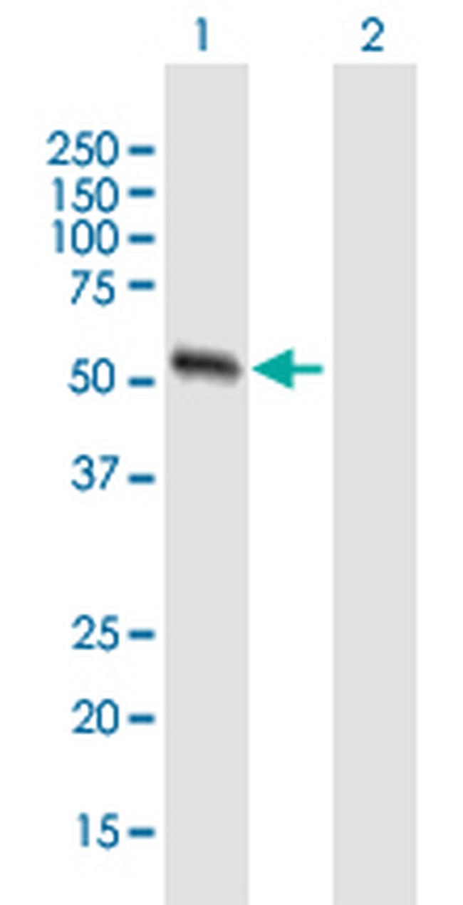 MMP13 Antibody in Western Blot (WB)