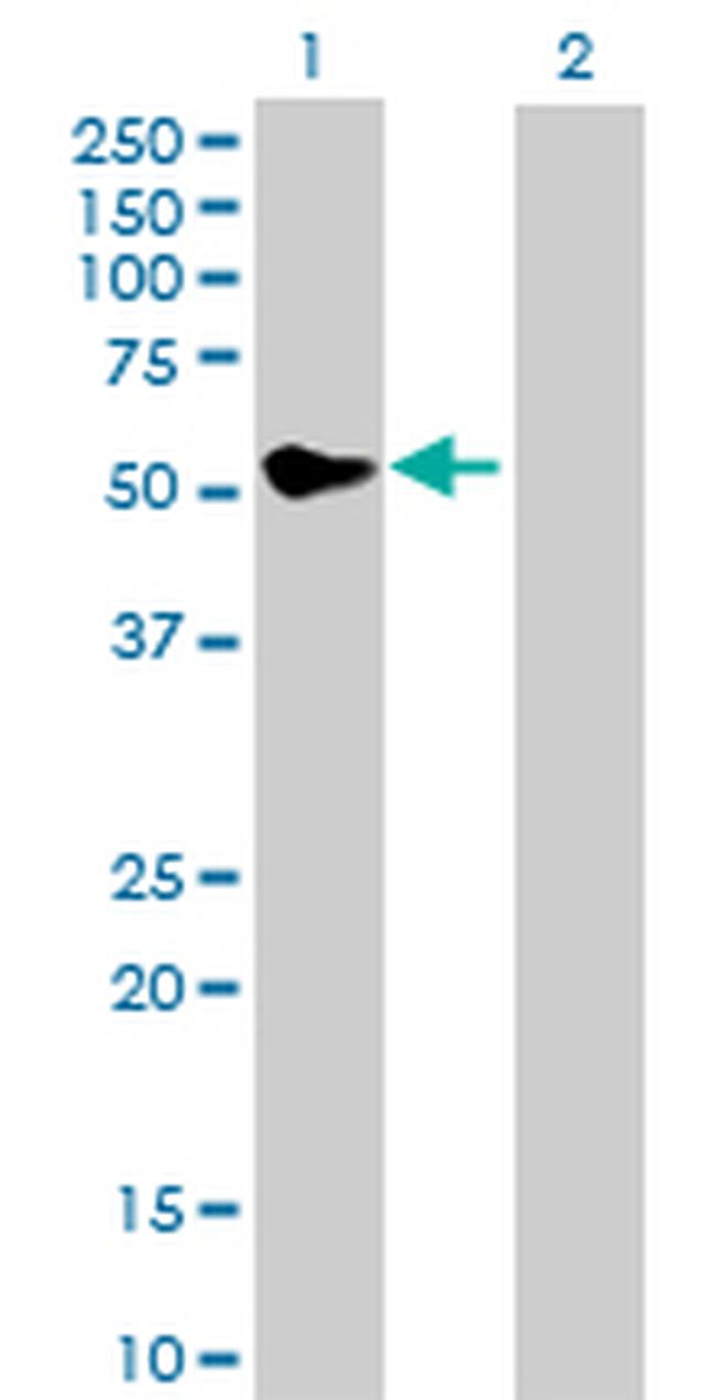 MMP13 Antibody in Western Blot (WB)