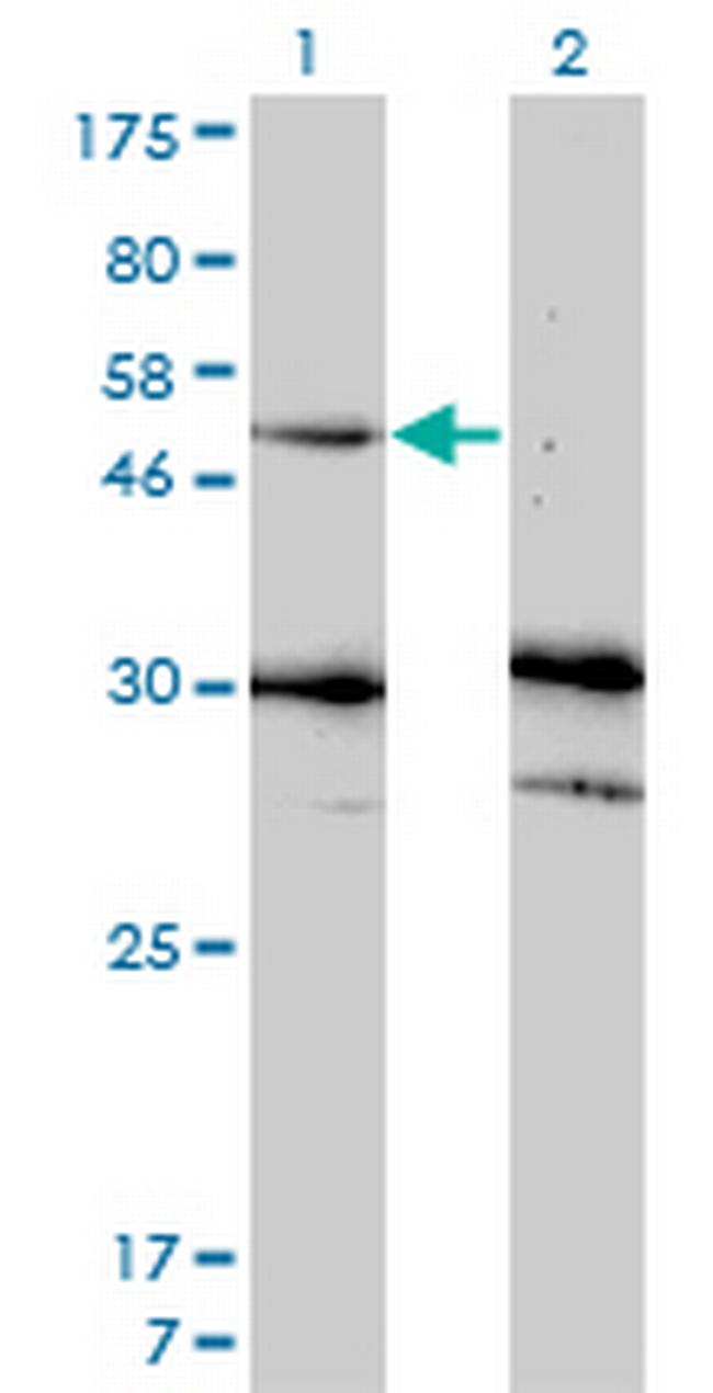 MMP13 Antibody in Western Blot (WB)