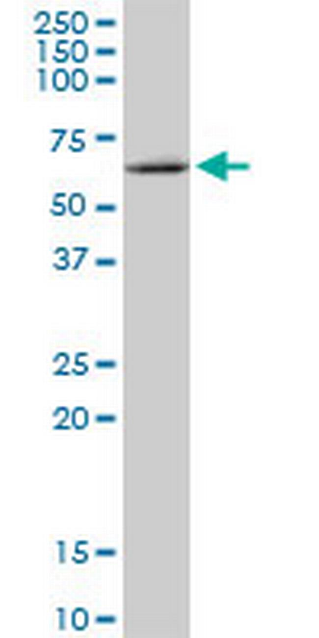 MMP19 Antibody in Western Blot (WB)