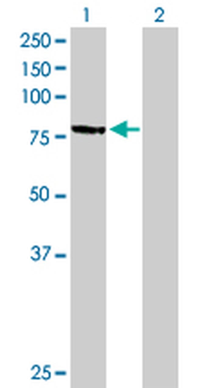 MPP3 Antibody in Western Blot (WB)