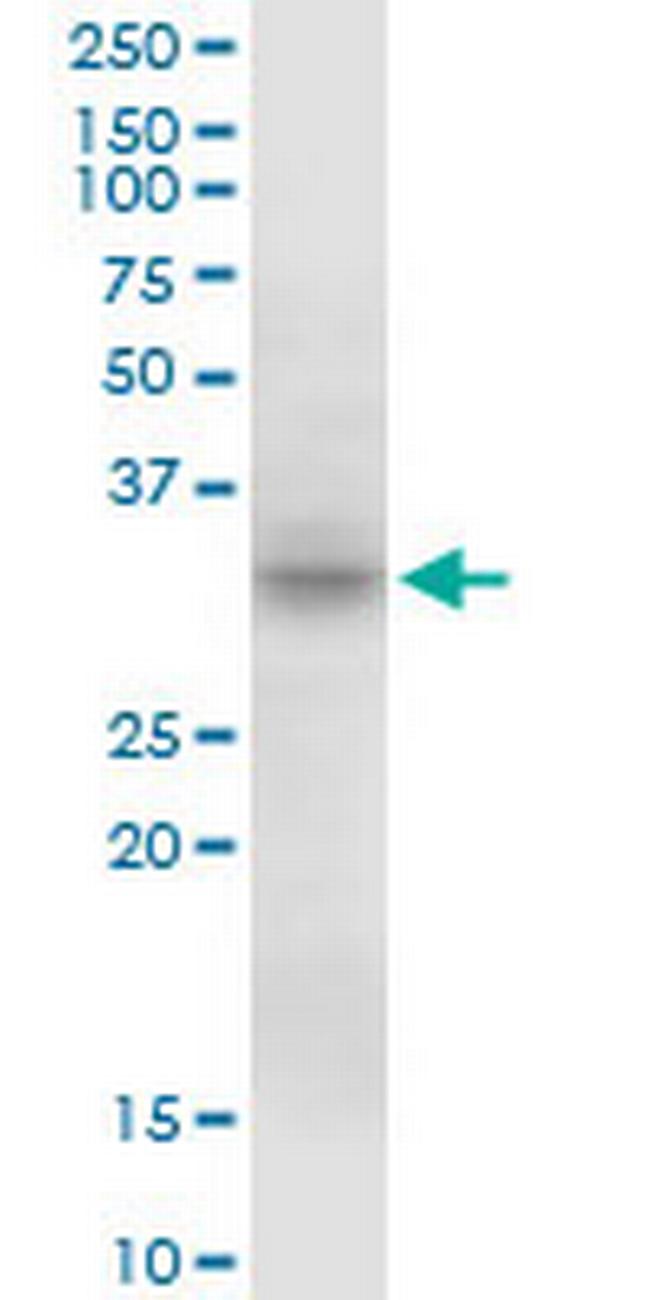 MPST Antibody in Western Blot (WB)