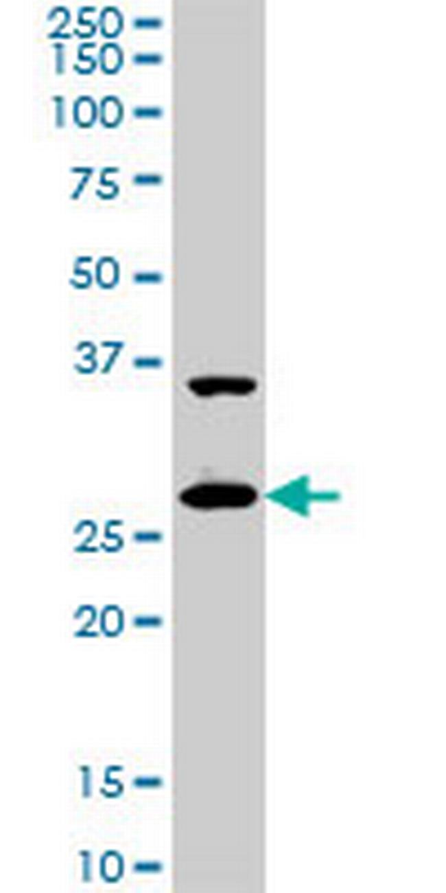 CITED1 Antibody in Western Blot (WB)