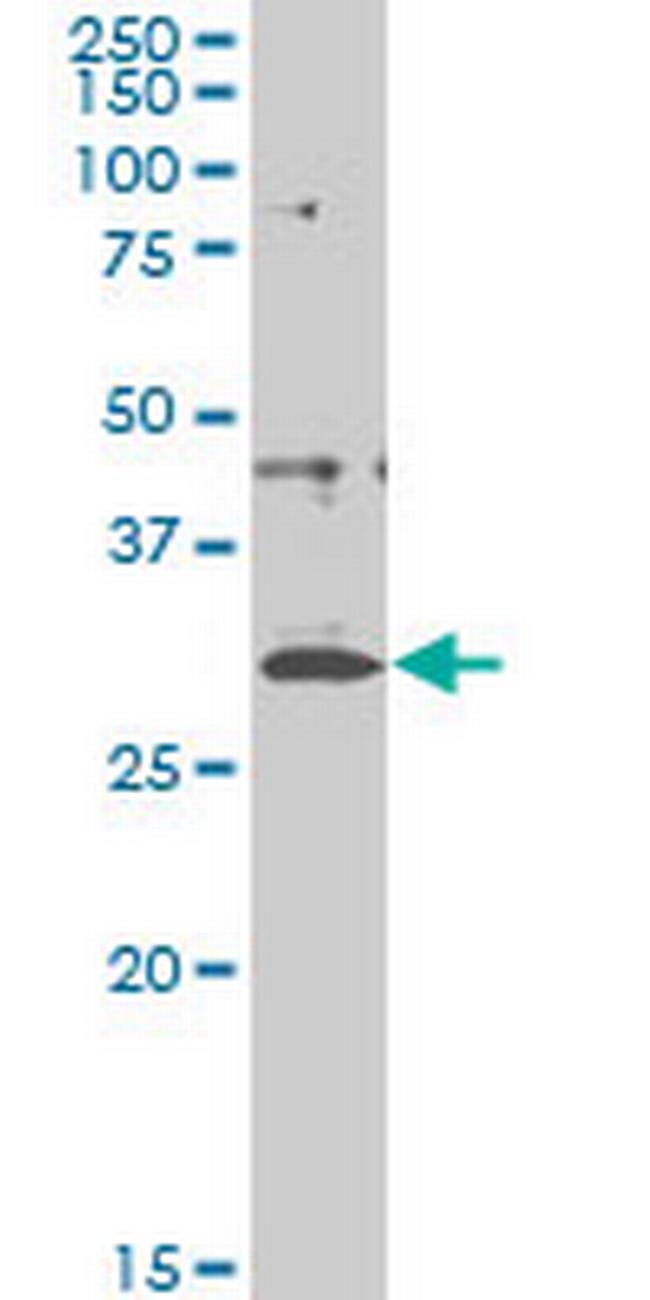 CITED1 Antibody in Western Blot (WB)