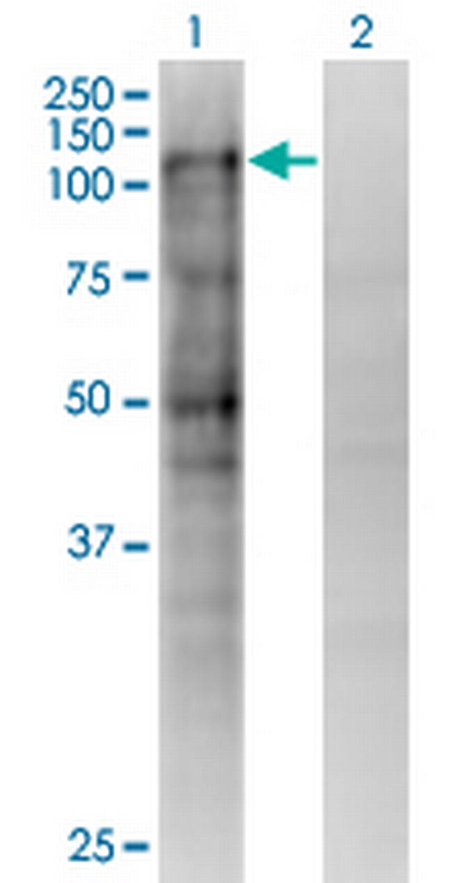 MSH2 Antibody in Western Blot (WB)