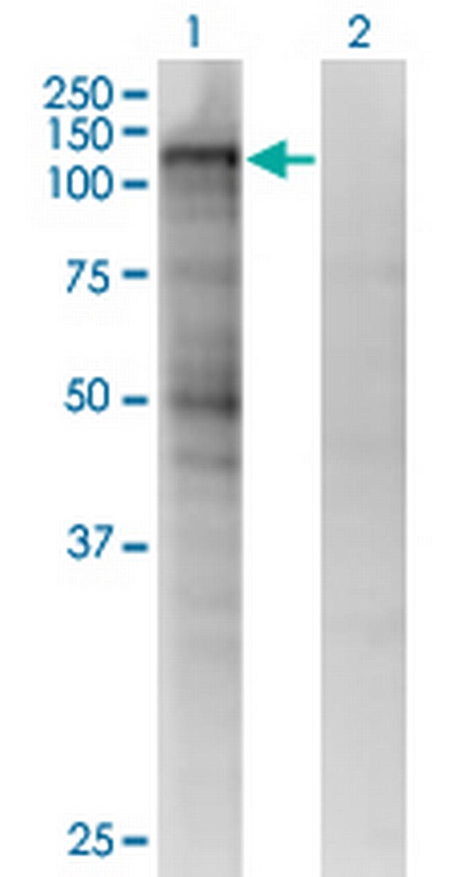 MSH2 Antibody in Western Blot (WB)