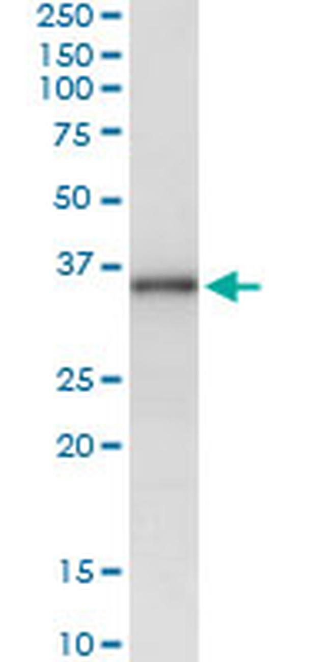 MSX1 Antibody in Immunoprecipitation (IP)