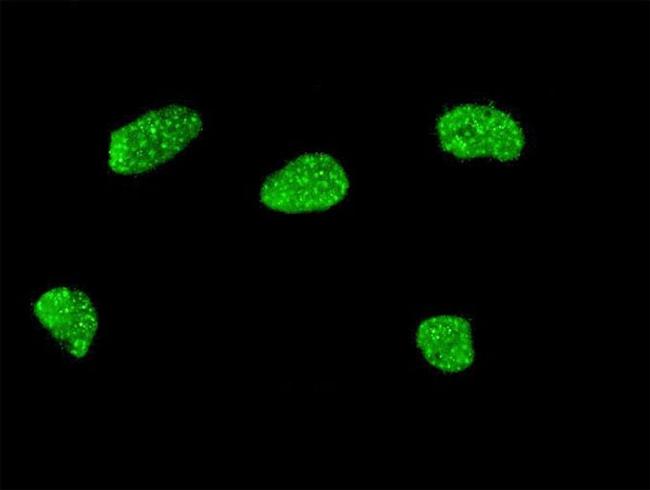 MSX2 Antibody in Immunocytochemistry (ICC/IF)