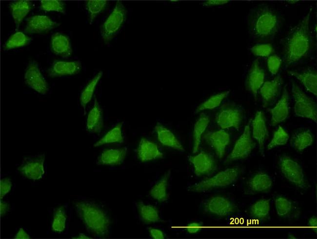 MTAP Antibody in Immunocytochemistry (ICC/IF)