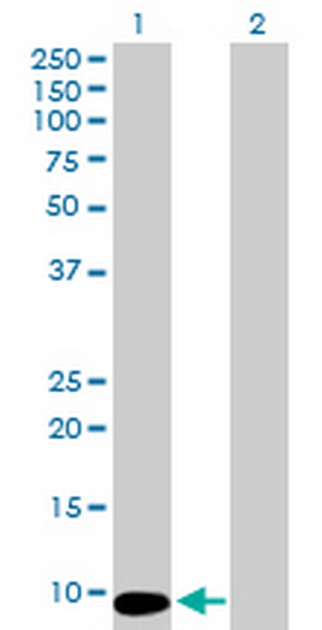 MTCP1 Antibody in Western Blot (WB)