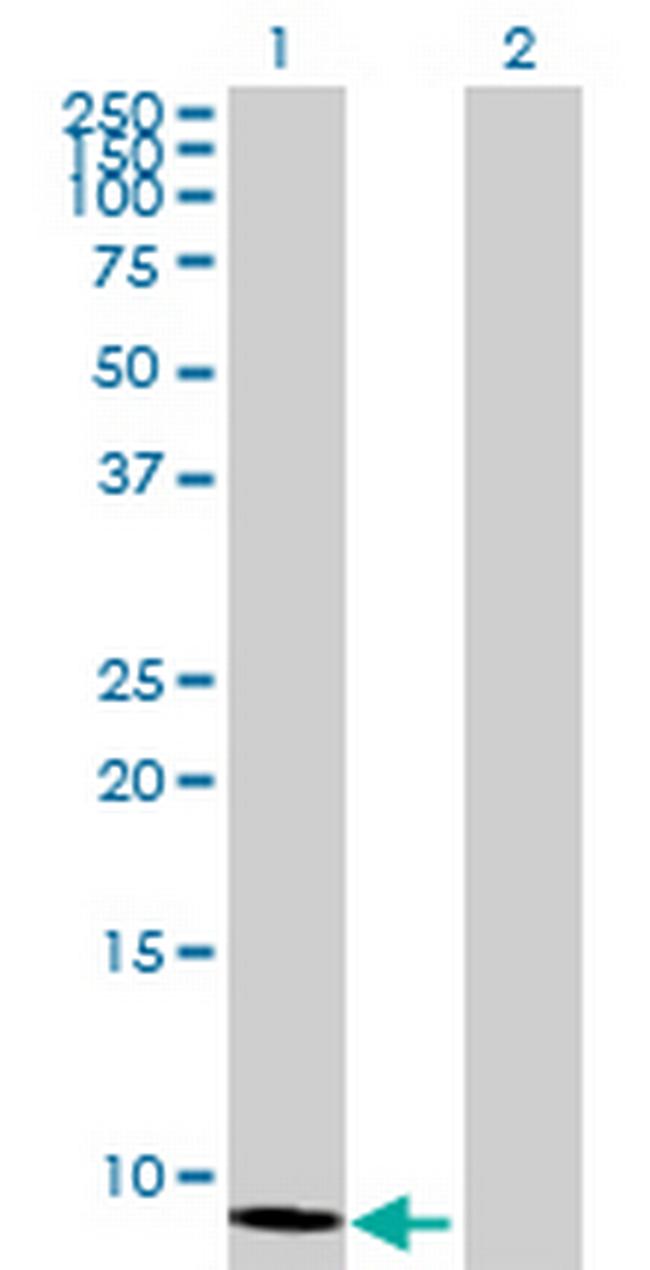 MTCP1 Antibody in Western Blot (WB)