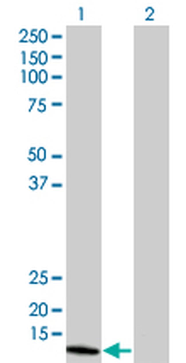 NUDT1 Antibody in Western Blot (WB)