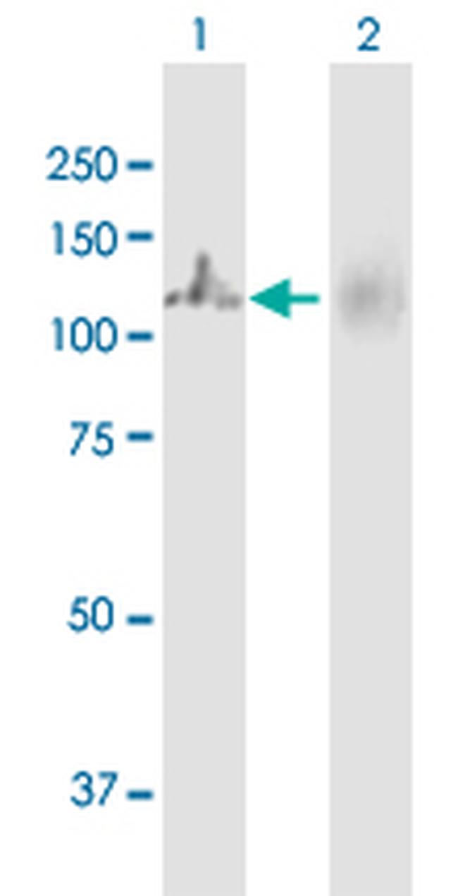 MTHFD1 Antibody in Western Blot (WB)