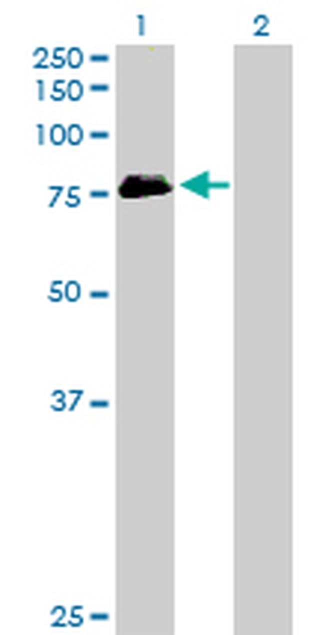 MTHFR Antibody in Western Blot (WB)