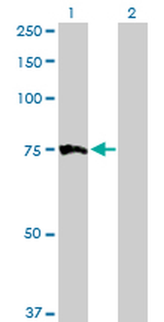 MTM1 Antibody in Western Blot (WB)