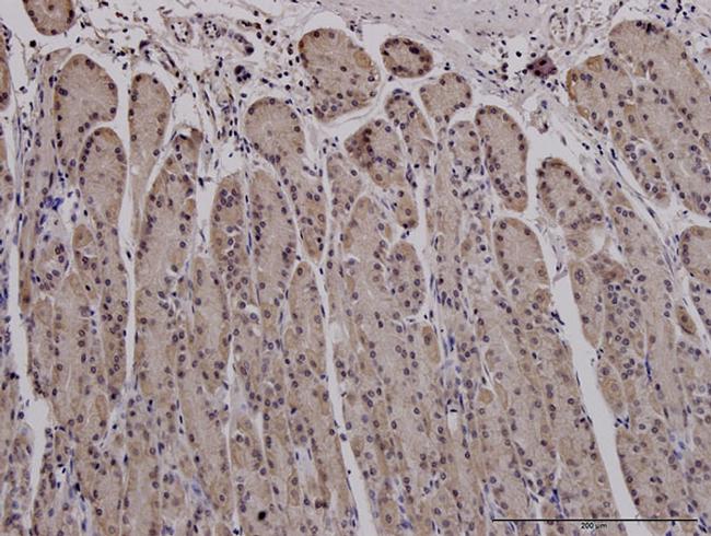 MUC4 Antibody in Immunohistochemistry (Paraffin) (IHC (P))