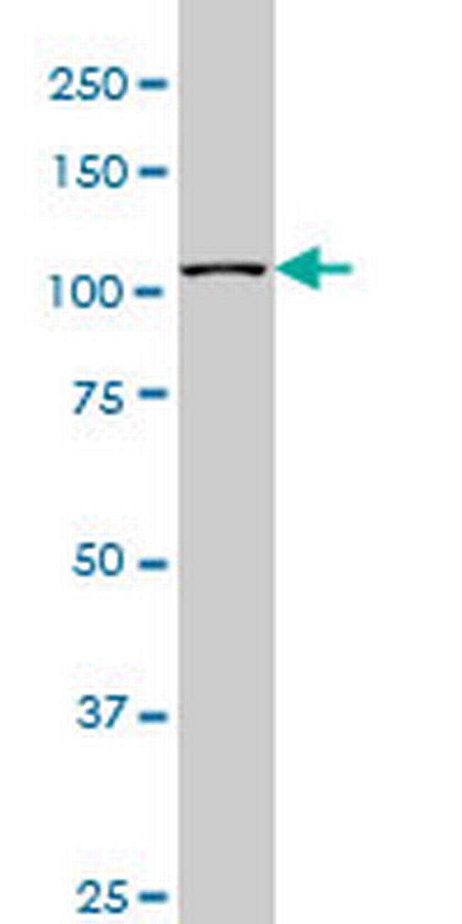 MUSK Antibody in Western Blot (WB)