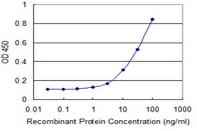 MUSK Antibody in ELISA (ELISA)