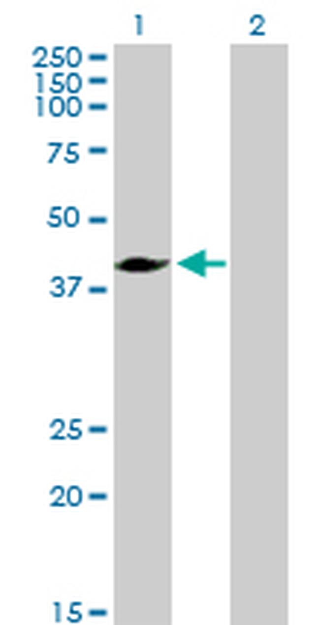 MVD Antibody in Western Blot (WB)