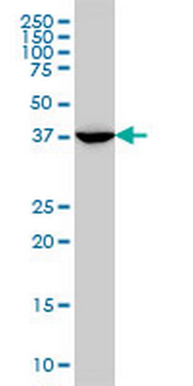 MVD Antibody in Western Blot (WB)