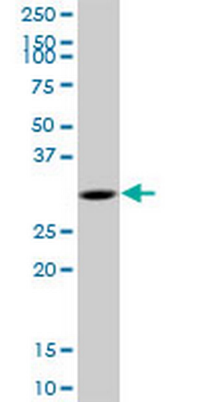 MYD88 Antibody in Western Blot (WB)