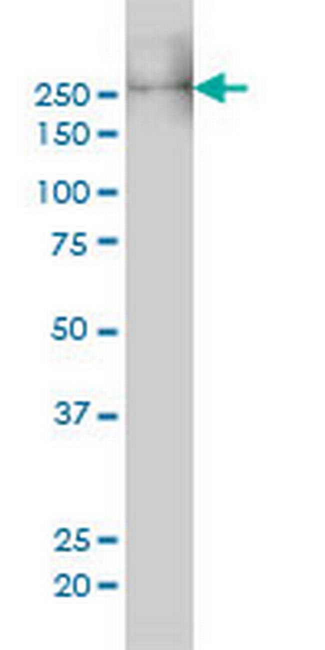 MYH9 Antibody in Western Blot (WB)