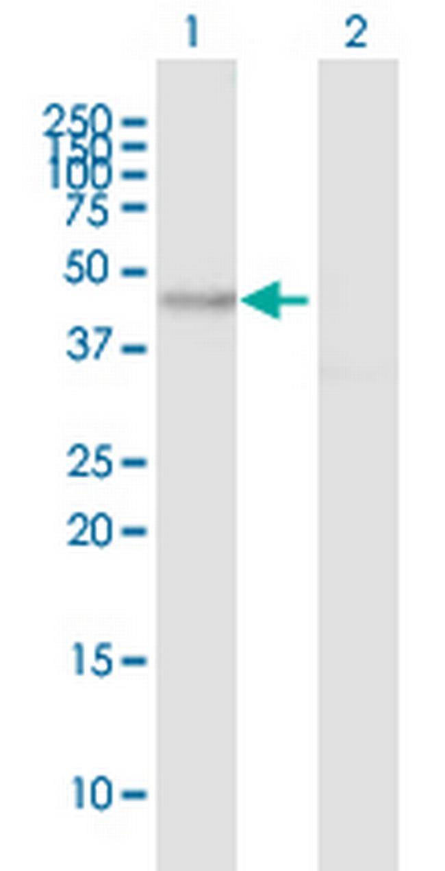 MYO1D Antibody in Western Blot (WB)