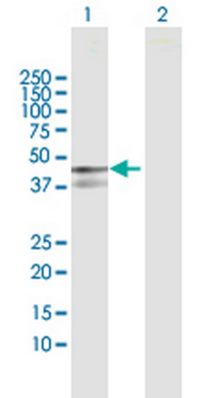 PPP1R12B Antibody in Western Blot (WB)