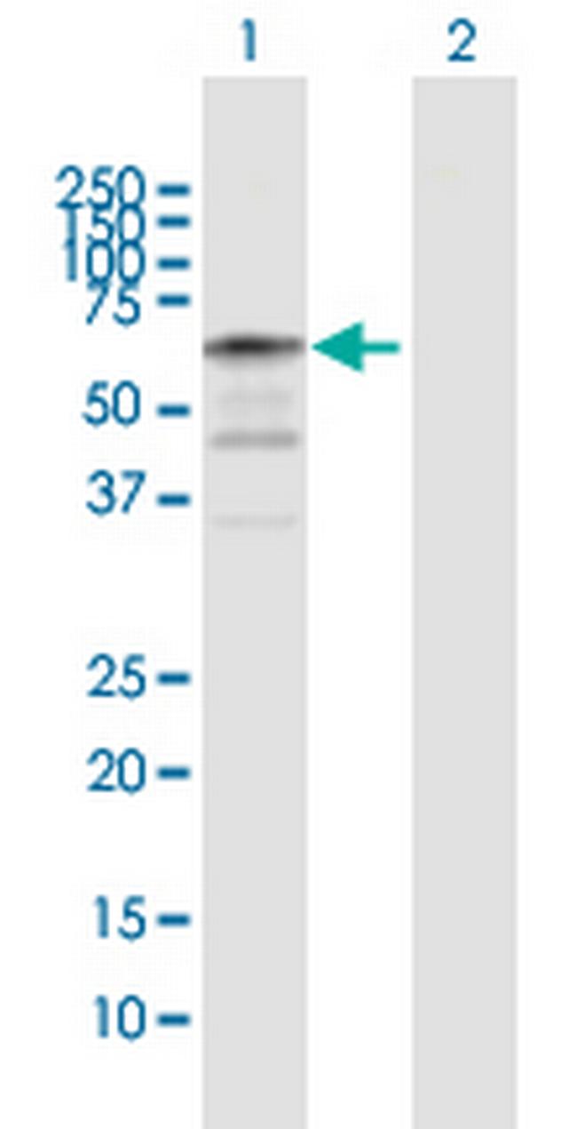 NAP1L2 Antibody in Western Blot (WB)