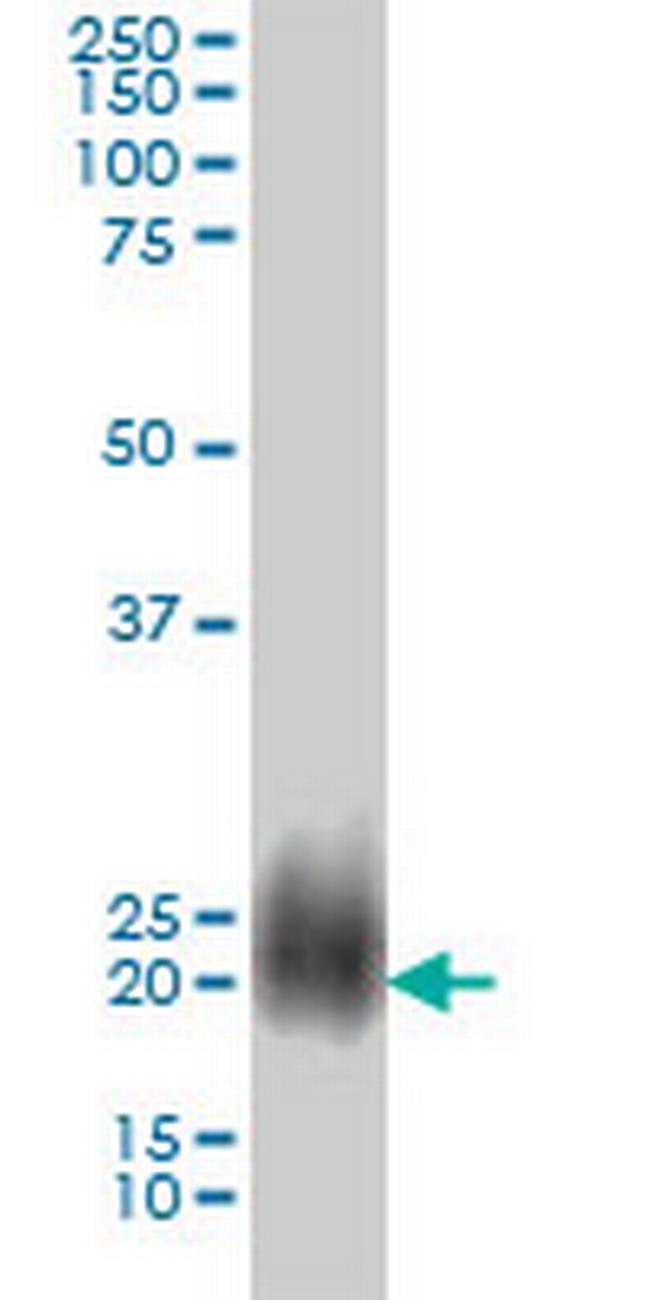 NBL1 Antibody in Western Blot (WB)