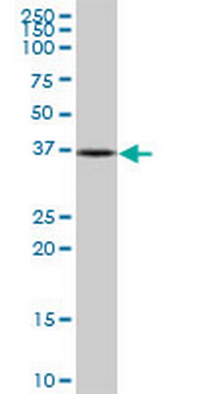 NUBP1 Antibody in Western Blot (WB)