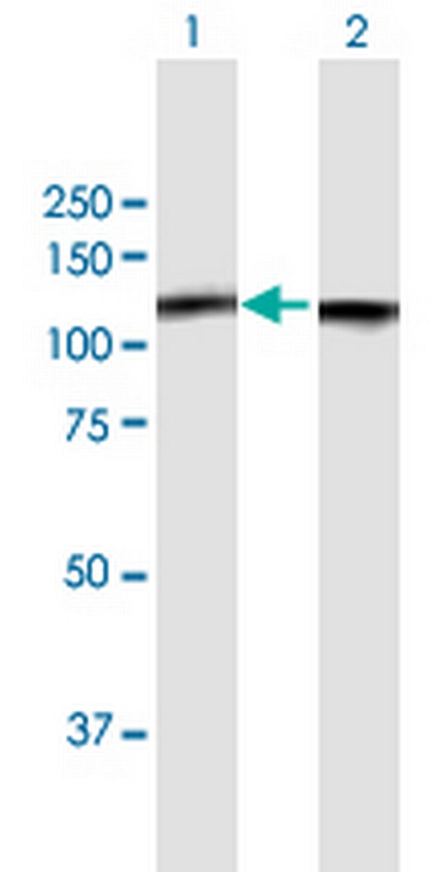 NCL Antibody in Western Blot (WB)