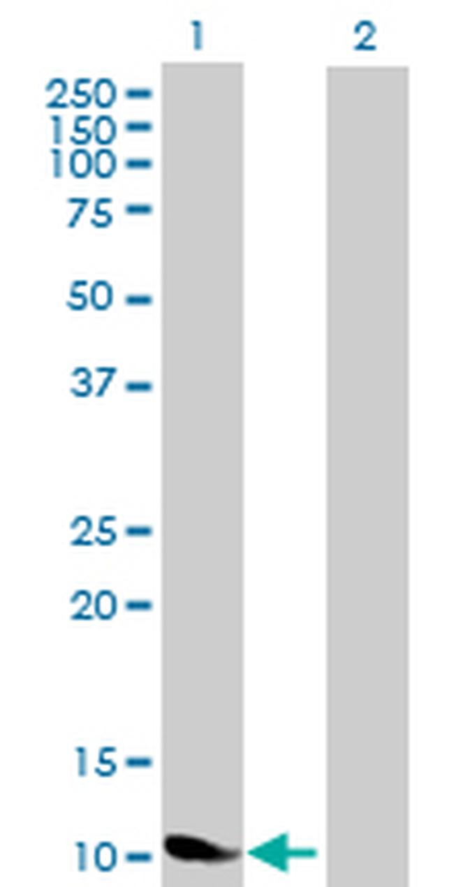 NDP Antibody in Western Blot (WB)