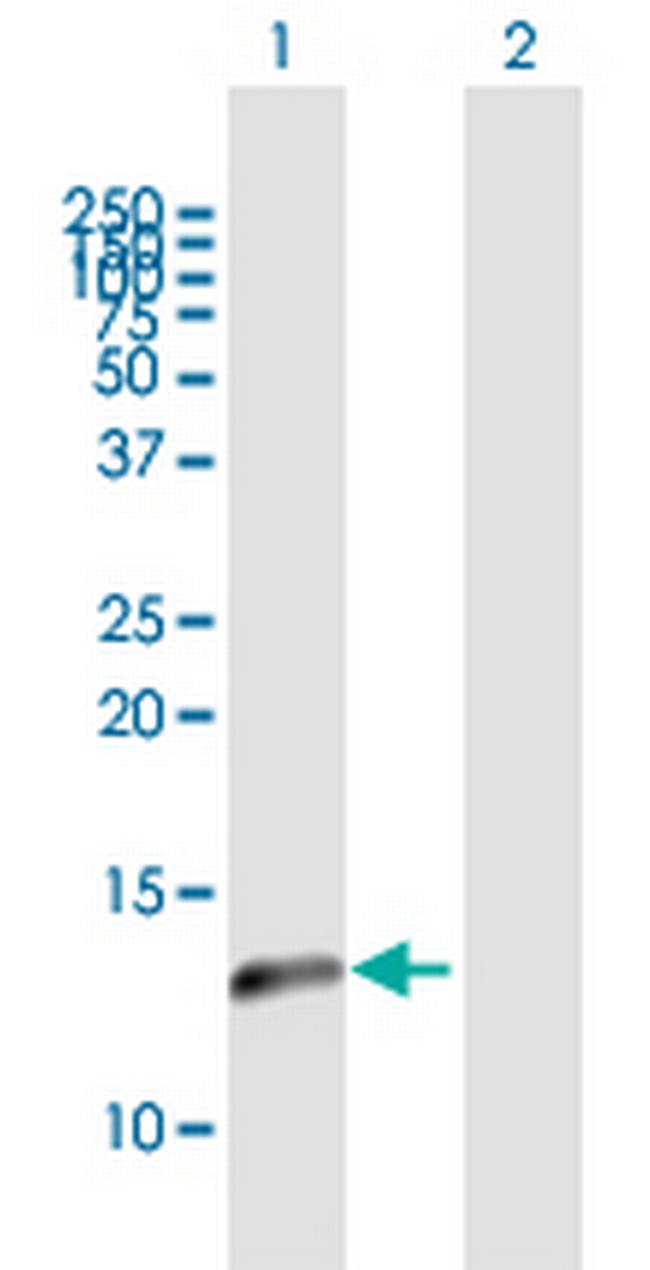 NDUFA5 Antibody in Western Blot (WB)