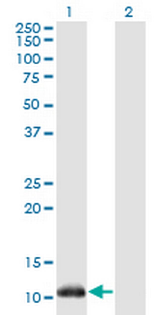 NDUFA5 Antibody in Western Blot (WB)