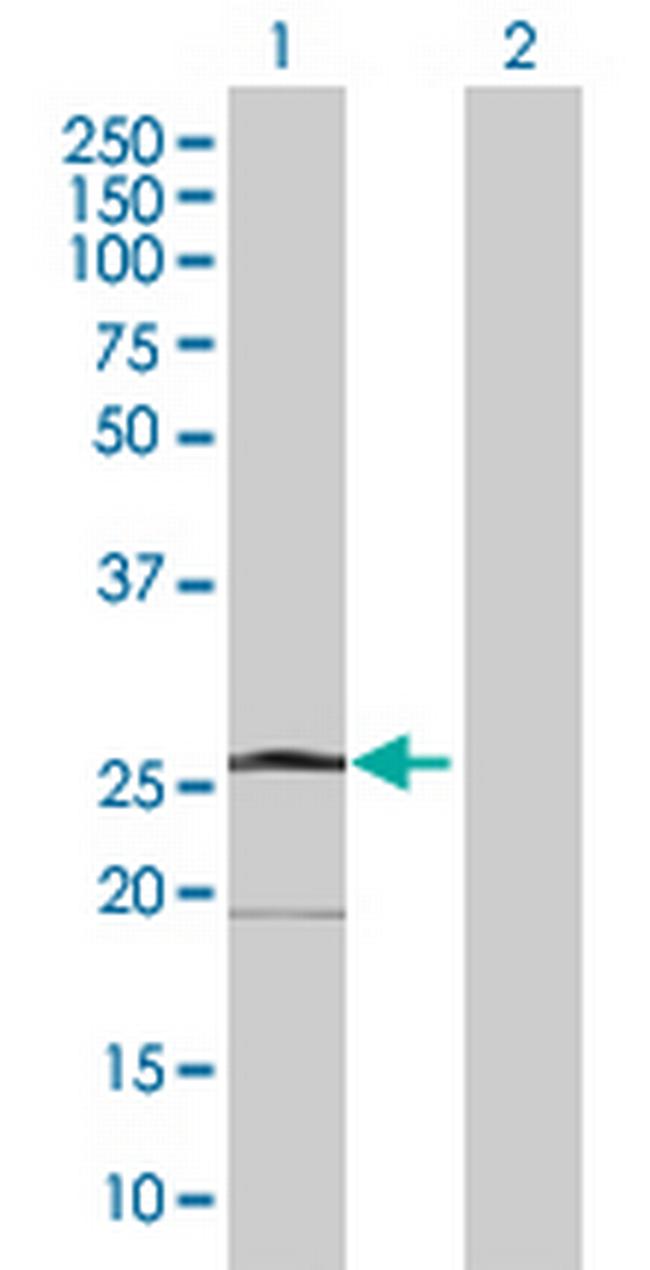 NDUFS4 Antibody in Western Blot (WB)