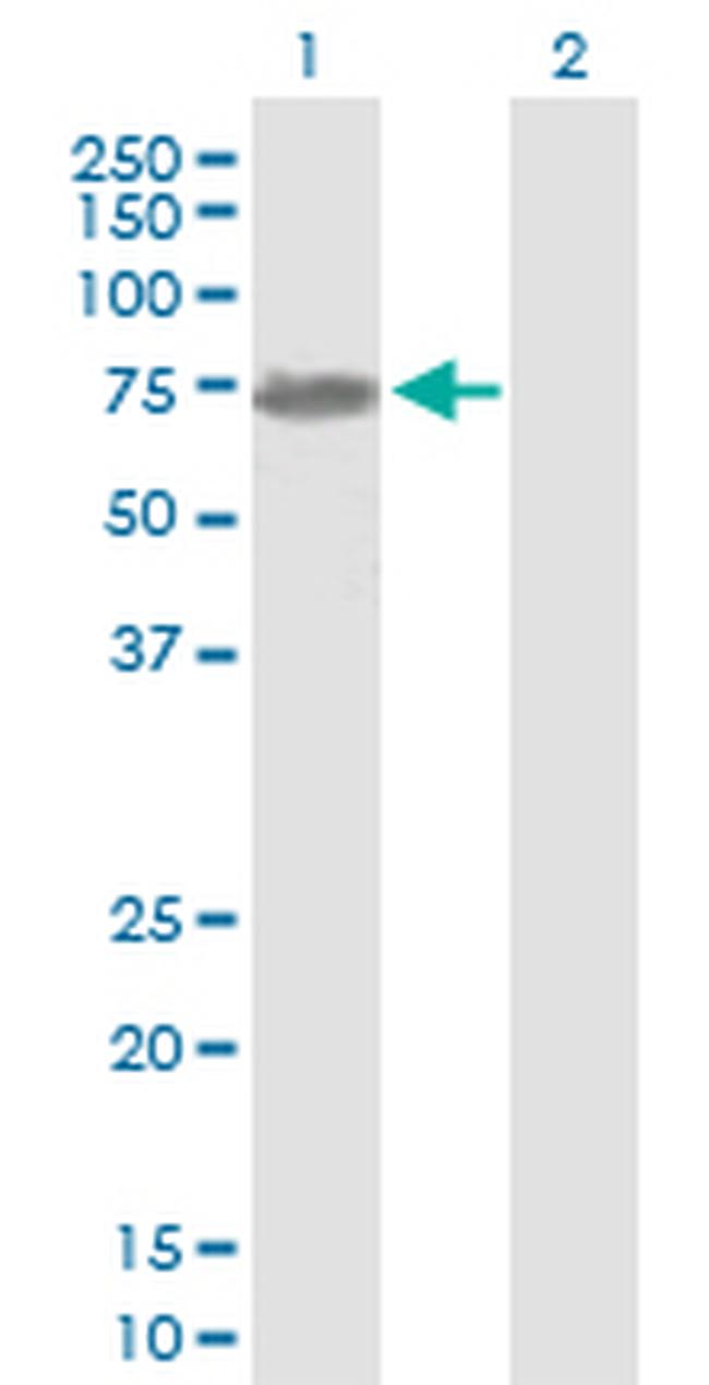 NEFL Antibody in Western Blot (WB)