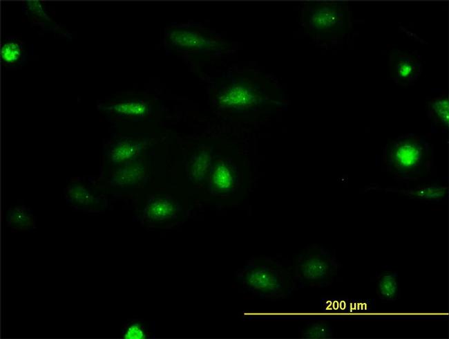 NEK2 Antibody in Immunocytochemistry (ICC/IF)