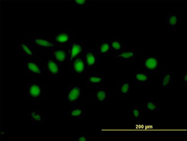 NFIX Antibody in Immunocytochemistry (ICC/IF)