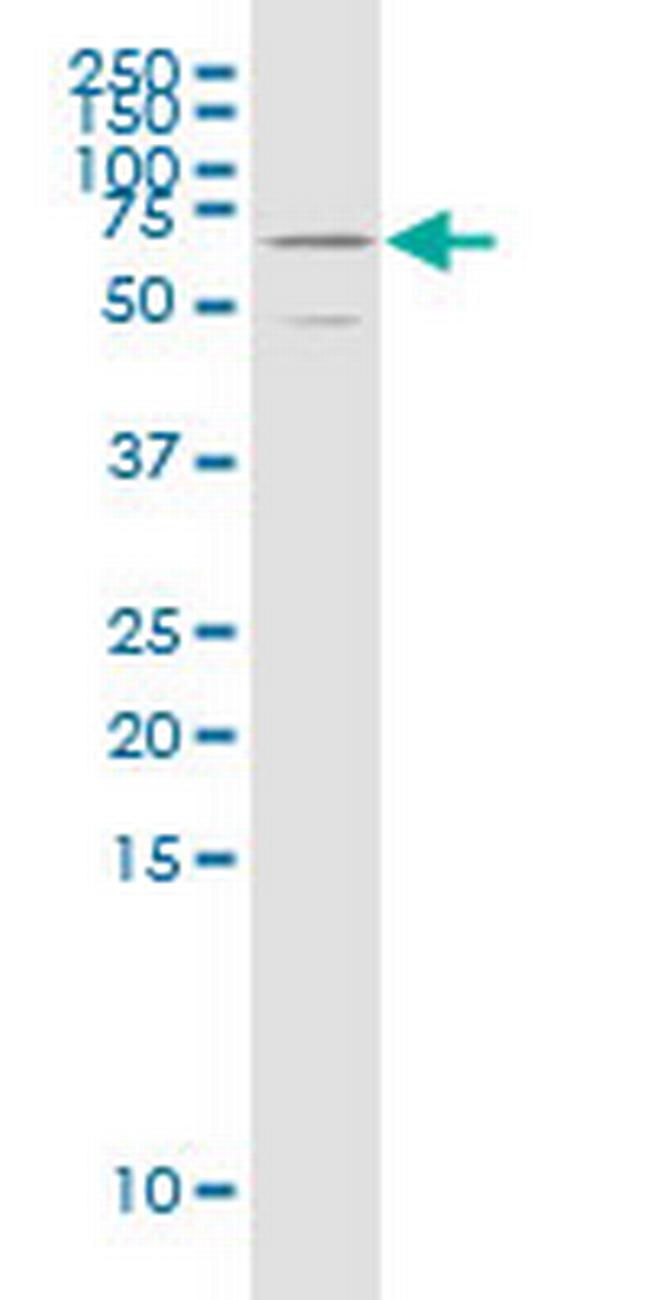 NFIX Antibody in Western Blot (WB)