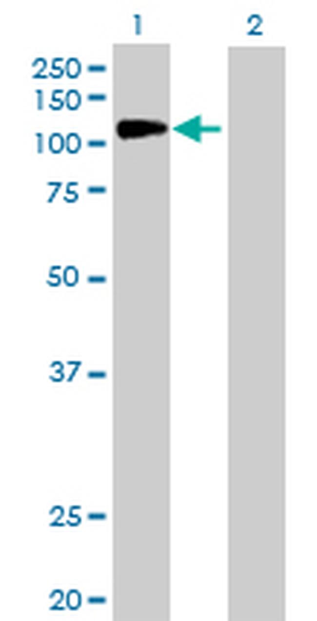 NFKB1 Antibody in Western Blot (WB)