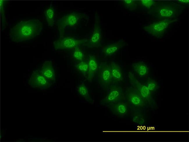 NFKB1 Antibody in Immunocytochemistry (ICC/IF)