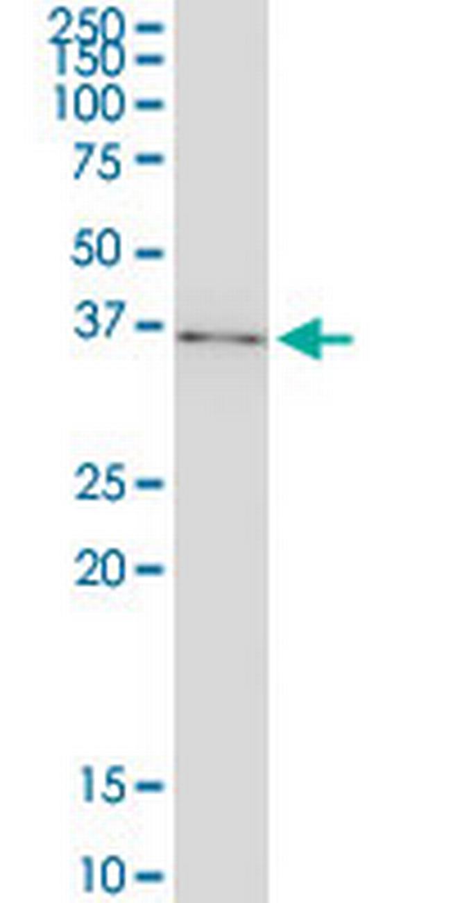 NFKBIA Antibody in Western Blot (WB)