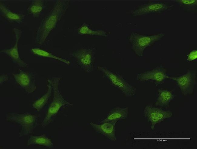 NME1 Antibody in Immunocytochemistry (ICC/IF)